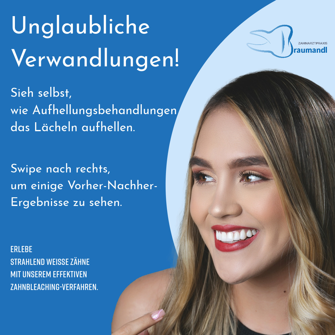 Unglaubliche Verwandlungen! Sieh selbst, wie Aufhellungsbehandlungen das Lächeln aufhellen.